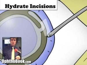 hydrating keratome incision