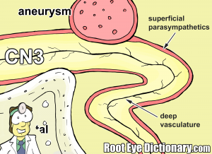Third Nerve Compression