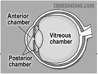 posterior chamber eye