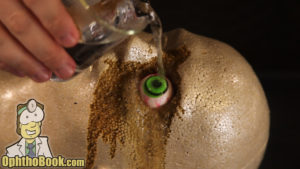 Acid and Base Burn Eye