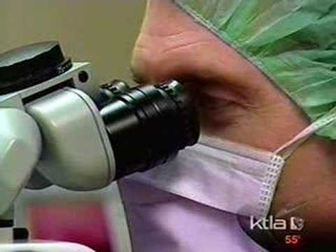 Keratoconus Treatment with Intacs and Riboflavin Crosslinking (Video)