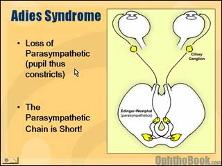 neurovideo-adies.jpg