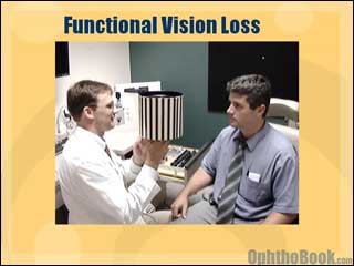 neurovideo-functional.jpg