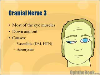 neurovideo-oculomotornerve.jpg