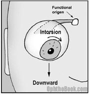 trochlear nerve palsy eye position