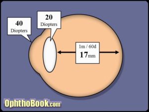 Diopter of the eye