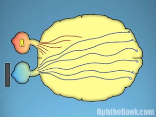 Amblyopia Nerves