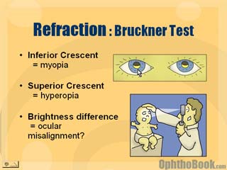 Bruckner Test