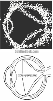 ret-retinaldetachmentultrasound.jpg