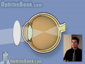 retinopathy - against motion