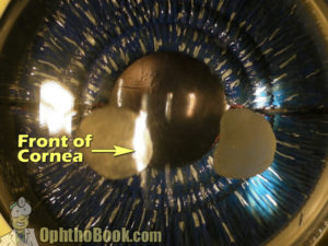 Model Eye - Front of Cornea