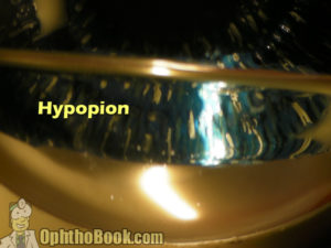 Model Eye - Hypopion