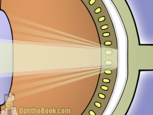 Retinal Tapetum Mirror