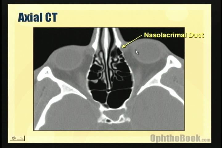 video-ctorbitalmuscles.jpg