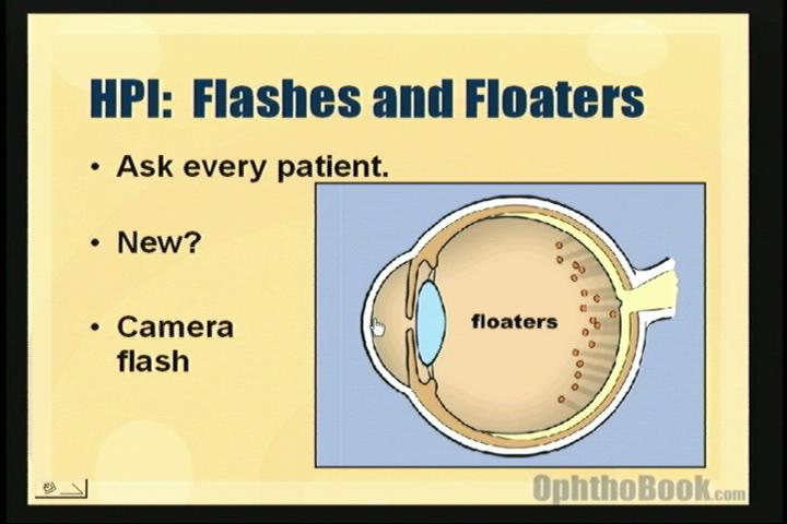 video-flashesandfloaters.jpg