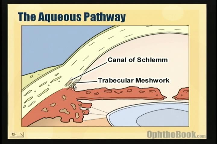 video-glaucoma-trabecular.jpg