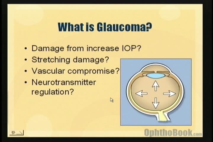 introduction-to-glaucoma-video-timroot