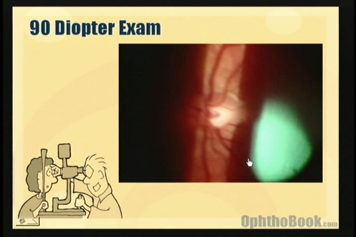 video-retina-90diopter.jpg