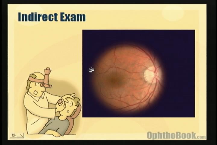 video-retina-indirect.jpg