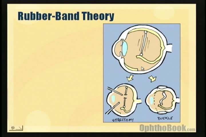 video-retina-rubberband.jpg